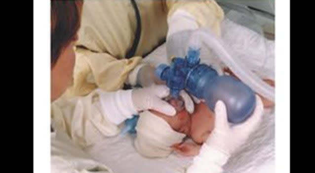 Babies were given nitrous oxide instead of oxygen.