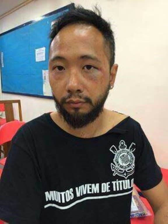 Ken Tsang after his alleged beating by police officers following scuffles between the police and pro-democracy protestors in Hong Kong on October 15, 2014