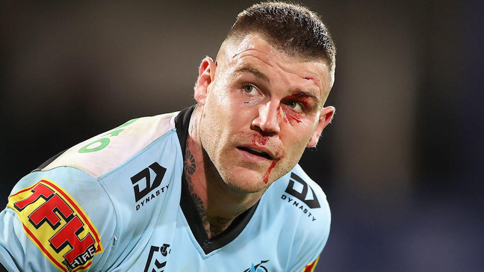 Pictured here, Josh Dugan has blood on his face during a game for Cronulla in the NRL.