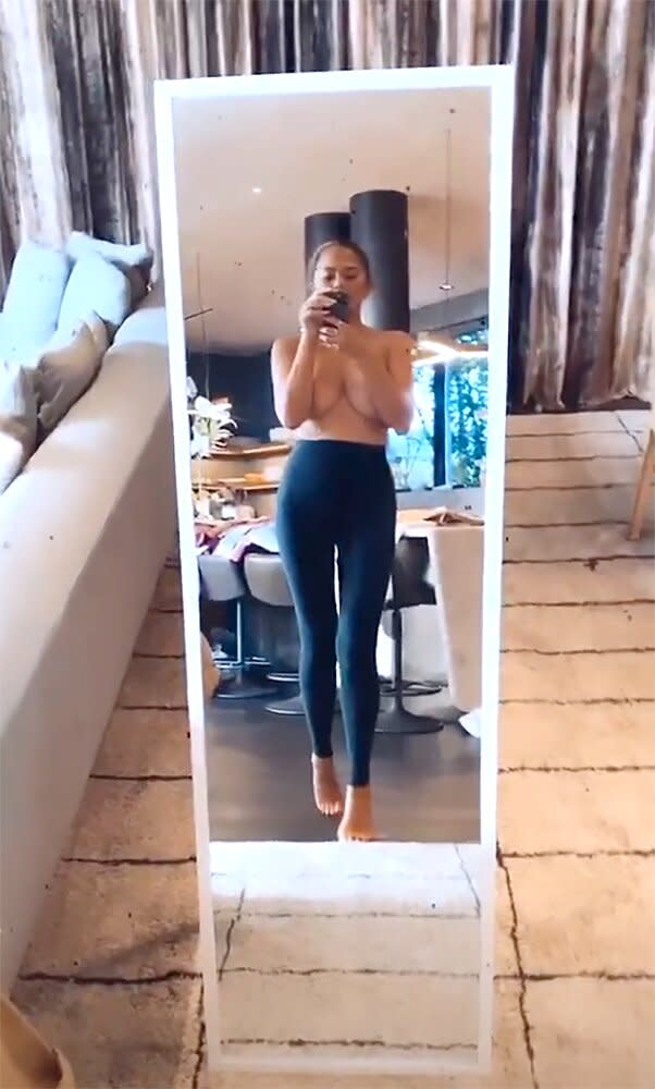 Chrissy Teigen Poses Topless on Instagram After Having Her Breast Implants  Removed