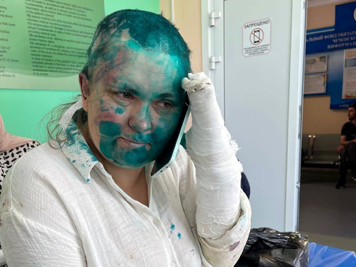Novaya Gazeta journalist Elena Milashina in hospital after beaing beaten in Grozny (AP)