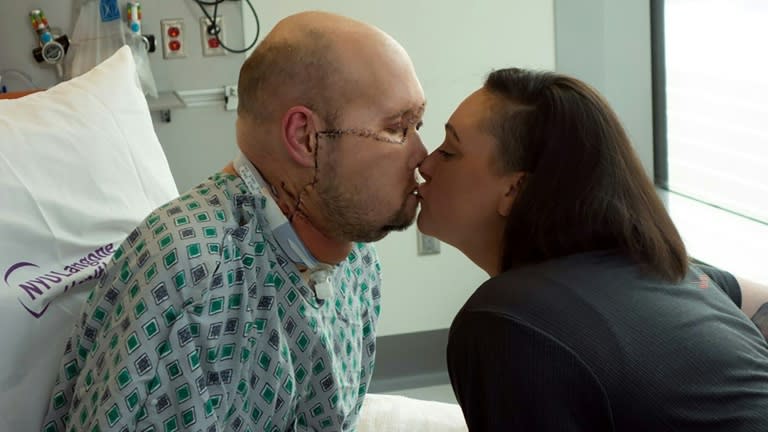 Aaron James (L) kisses his wife Meagan while he recovers from the first whole-eye and partial face transplant, at NY Langone Health in New York (Handout)