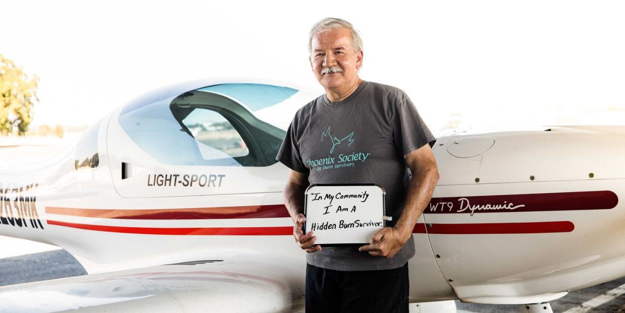 rich casias a burn survivor standing in front of a small white airplane