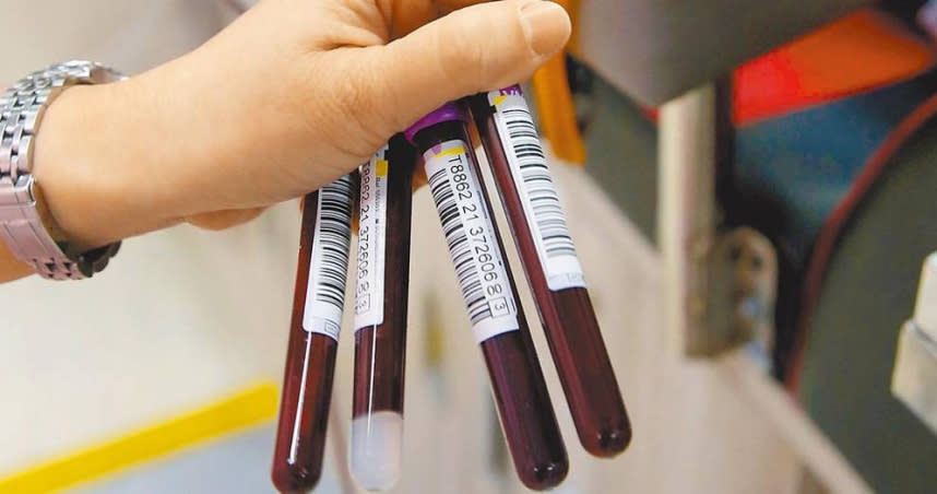疫情指揮中心23日公布5大COVID-19加強監測方案，針對2021年4到7月捐血者，5000多人的血清，分析自然感染以及接種疫苗抗體，了解自然盛行率相關地理分布和趨勢變化，預計下個月底前會有結果。圖為民眾捐血取樣檢驗。（圖／中國時報王英豪攝）