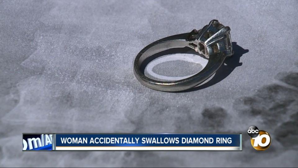 This diamond engagement ring was removed from a California woman's stomach last week after she said she swallowed it while sleepwalking.  (Photo: ABC 10)