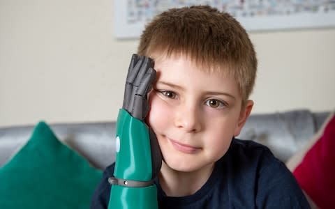 Freddie Cook was given his 'hero arm' days before his eighth birthday  - Credit: swns