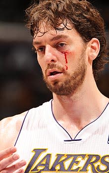 Pau Gasol left the Lakers' Game 1 loss with a cut after his left eye after getting hit