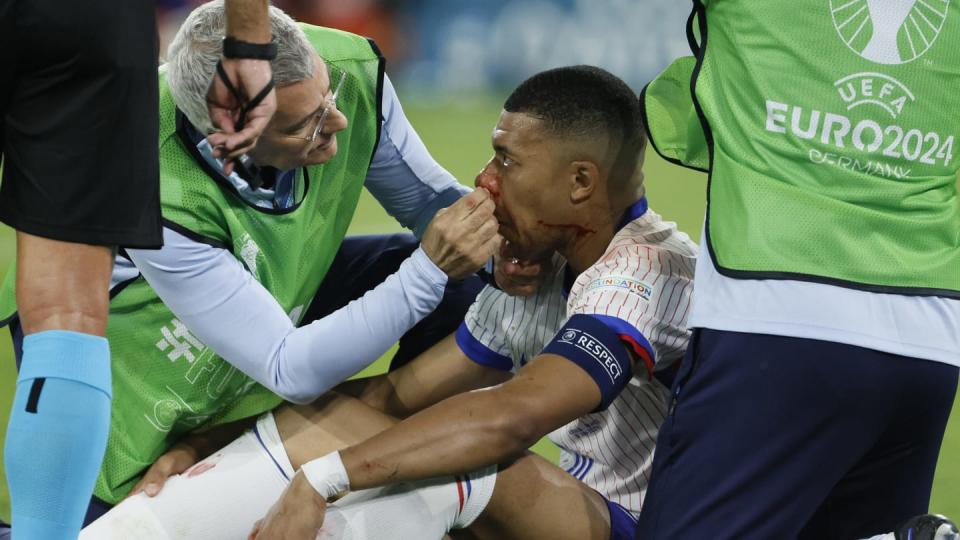 France confirm Kylian Mbappe injury plan after horror broken nose