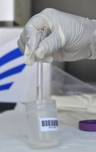 A medical worker tests for Tuberculosis (TB) in Carletonville, South Africa on March 24, 2012. Resistance to TB drugs develops when treatment fails to kill the bacteria that causes it -- either because the patient fails to follow their prescribed dosages or, as in this case, the drug doesn't work