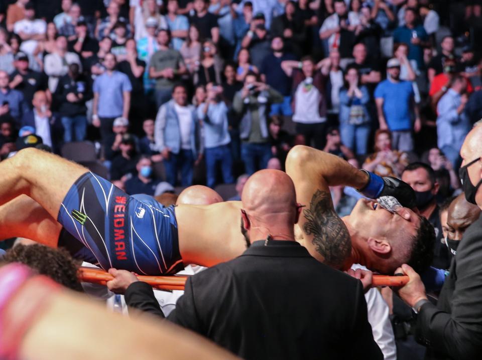 Chris Weidman was taken to hospital and will undergo surgery tomorrow (Getty Images)