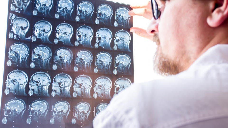 Doctors evaluation results of magnetic resonance imaging of brain in hospital concept photo. Neurologist in glasses keeps hand on glass of negatoscope MRI scan and examines structure of brain tissue