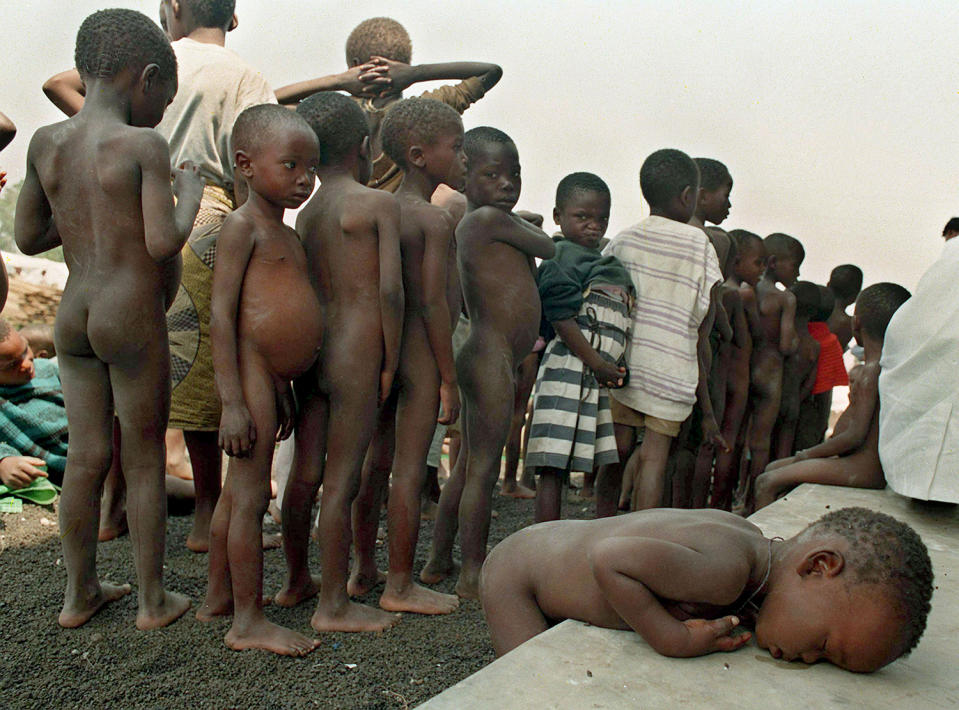 <p>A Rwandan child, too weak from malnutrition to stand in line for vaccination, rests his head on a ledge at a crowded refugee camp for orphaned children in Ndosho, Zaire (Democratic Republic of the Congo), near Goma, July 28, 1994. (Photo: Jacqueline Larma/AP) </p>