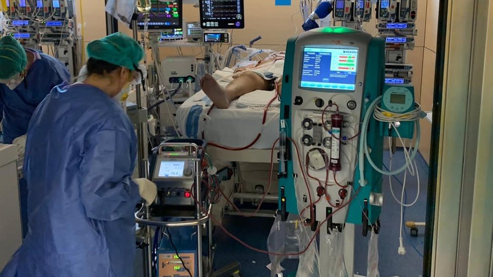 Un paciente conectado a una máquina de ECMO en el Hospital Vall d´Hebron