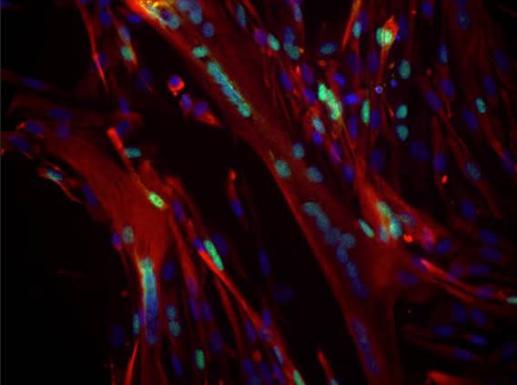 A fusion of several stem cells, called a myotube, obtained in vitro from a human muscle collected 17 days after the individual's death. The colored markers authenticate that they are muscle cells.