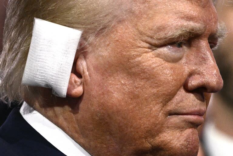 Donald Trump, con una venda en la oreja derecha, en Milwaukee, Wisconsin. (Brendan SMIALOWSKI / AFP)