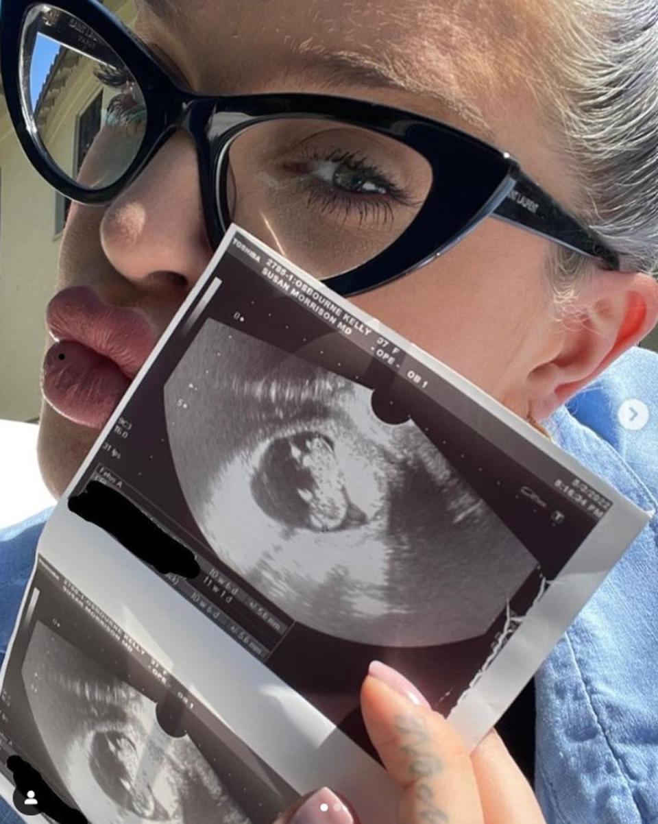 The star announced her pregnancy in May on Instagram (Instagram/KellyOsbourne)