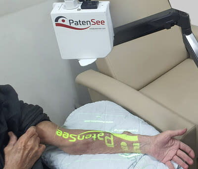 PatenSee’s contactless monitoring system for the early detection of vascular access stenosis in hemodialysis patients