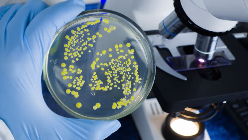 Bacteria is pictured in a laboratory. What diseases are Americans most afraid of?