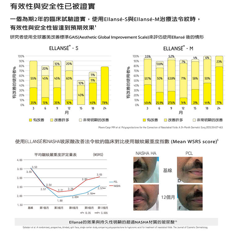 最夯長效拉提補凹 悄悄變精緻盛世美顏