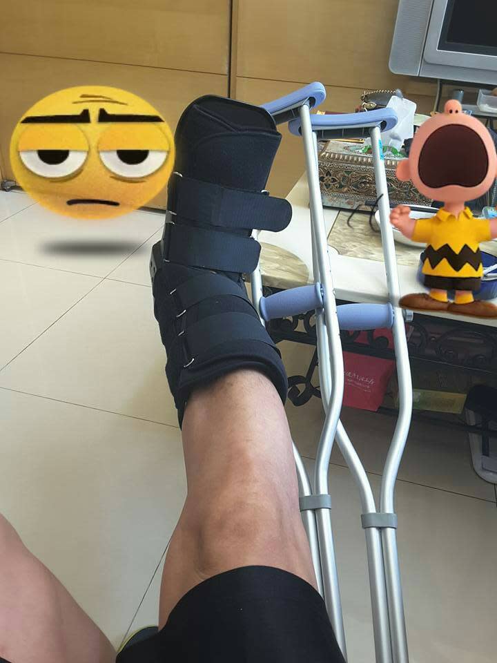 薛志正車禍腿斷掉。（圖／翻攝自薛子騛臉書）