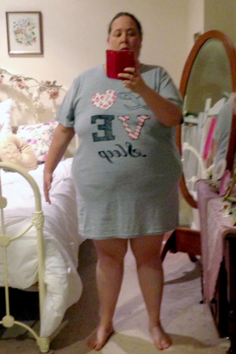 Turner was 25 stone and four pounds at her heaviest weight. [Photo: Caters News]