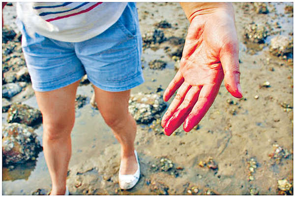 如果皮膚有傷口，或掘蜆時被海產刺傷，隨時會導致細菌感染。