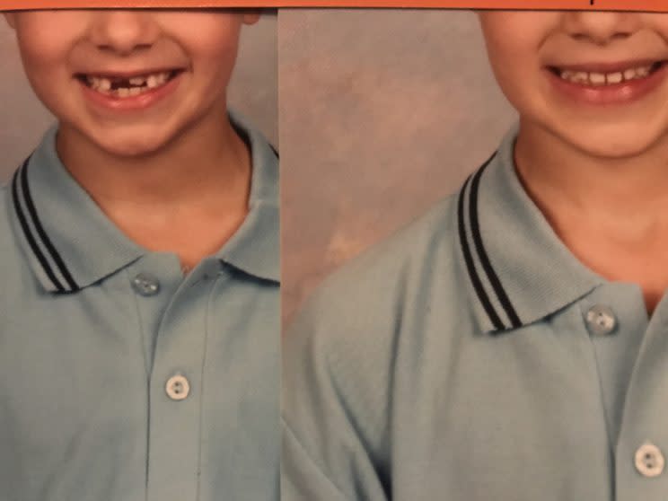 The class picture, before and after the digital altering, which added teeth. (Photo: Angela Pickett/Words by Ange)