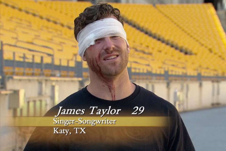 James Taylor's Eye Injury