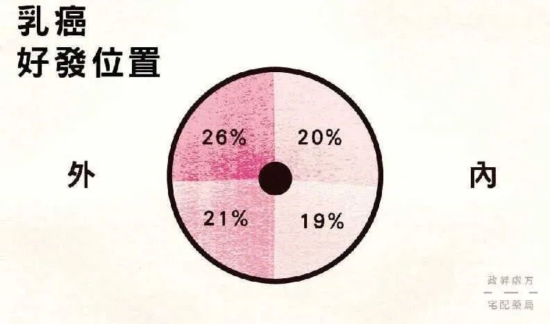 張金堅醫師警告，台灣乳癌好發年齡比歐美少10歲。（圖／翻攝自政昇藥局）