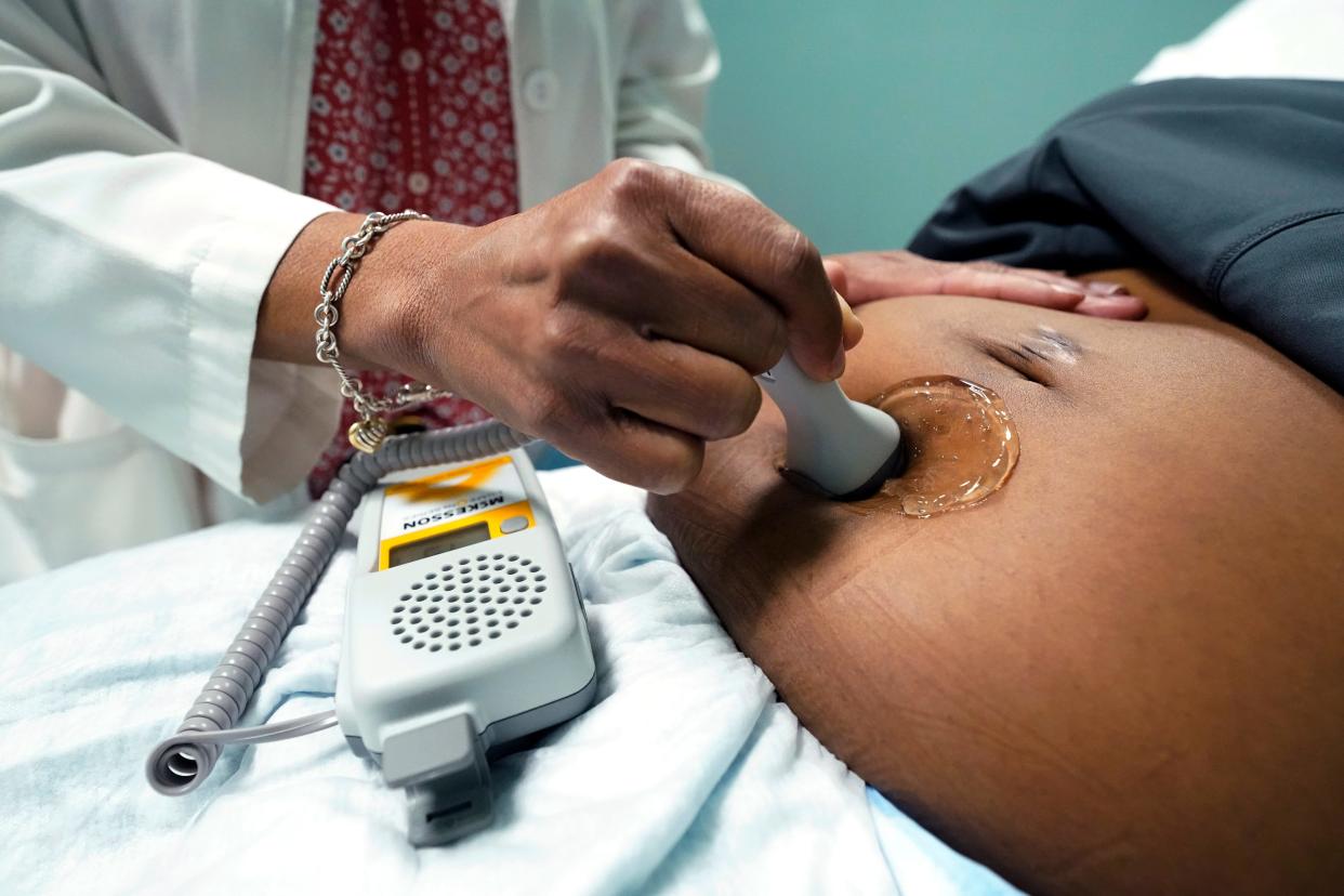 A doctor uses a hand-held Doppler probe on a pregnant woman to measure the heartbeat of the fetus on Dec. 17, 2021, in Jackson, Miss.
