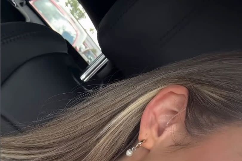 Holly Hagan shows off her hearing aids