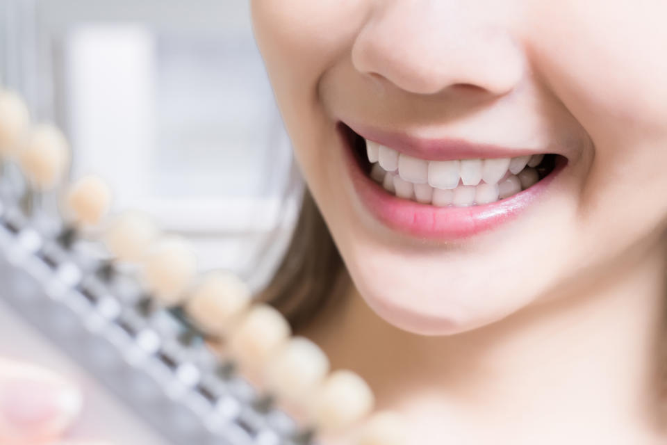 At home tooth whitening may not be as effective as hoped.  (Image posed by model, Getty Images)