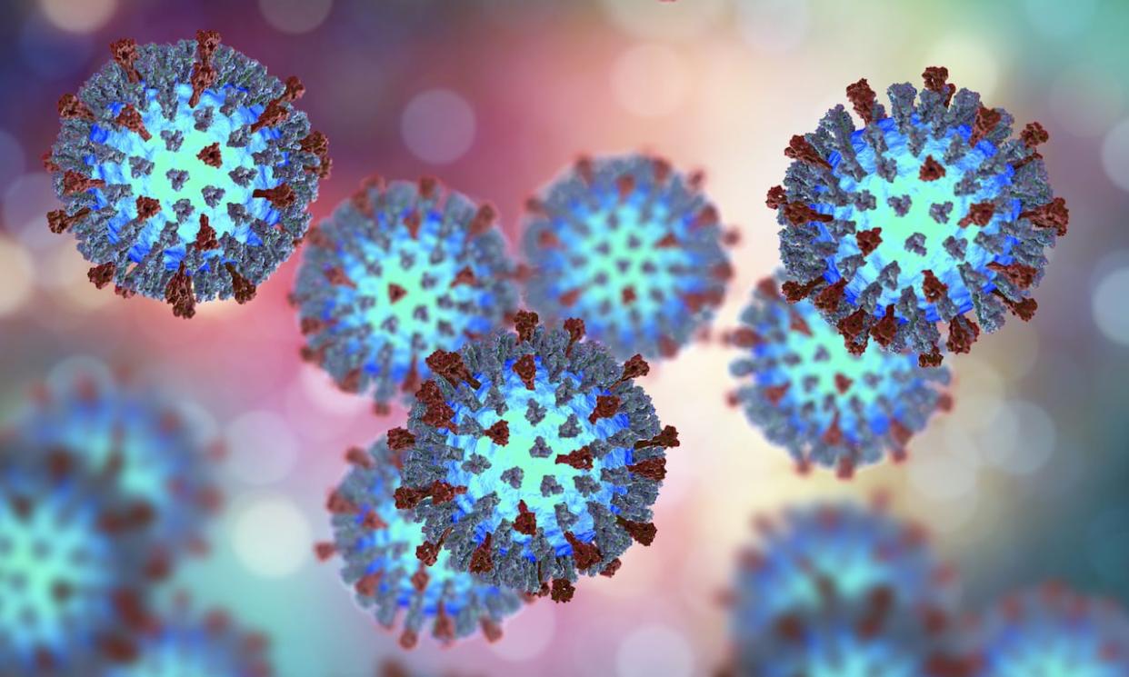 A 3D illustration showing structure of measles virus with surface glycoprotein spikes heamagglutinin-neuraminidase and fusion protein. (Shutterstock - image credit)