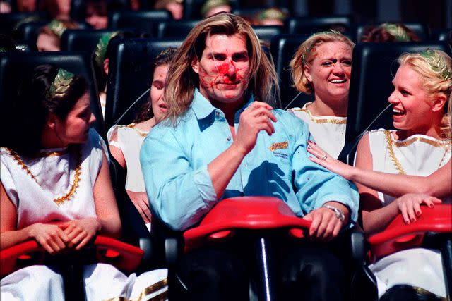 Steve Earley/Virginian-Pilot/AP Fabio after the rollercoaster incident in 1999.