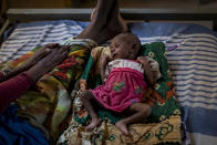 Abeba Gebru, 37, from the village of Getskimilesley, sits with her malnourished daughter, Tigsti Mahderekal, 20 days old, in the treatment tent of a medical clinic in the town of Abi Adi, in the Tigray region of northern Ethiopia, on Tuesday, May 11, 2021. For every mother like Abeba who makes it out, hundreds, possibly thousands, are trapped behind the front lines or military roadblocks in rural areas. (AP Photo/Ben Curtis)