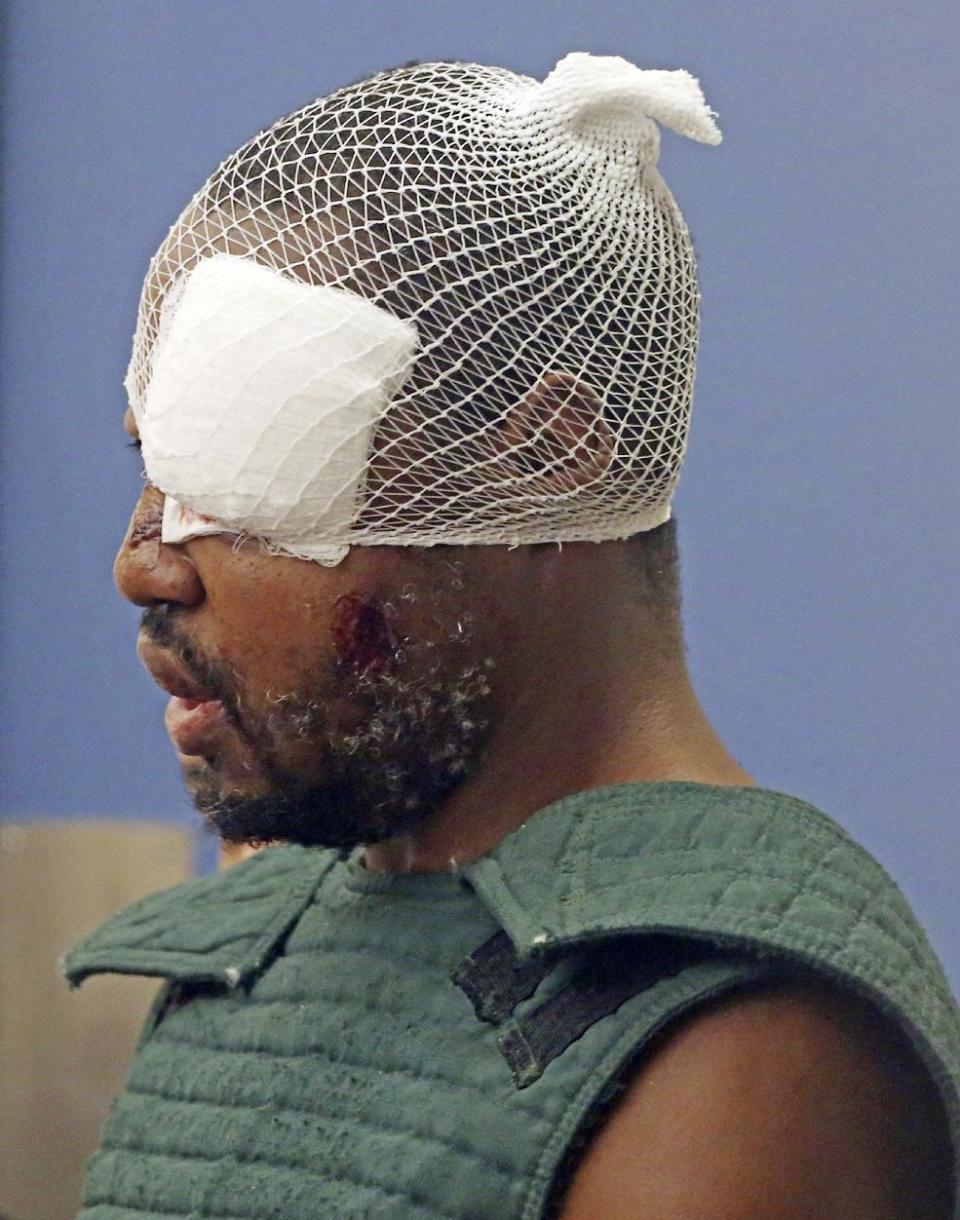 Markeith Loyd, suspected of fatally shooting a Florida police officer, attends his initial court appearance Thursday, Jan. 19, 2017, at the Orange County Jail, in Orlando, Fla. Loyd spoke out of turn and was defiant during the appearance on charges of killing his pregnant ex-girlfriend. He was injured during his arrest Tuesday night following a weeklong manhunt. (Red Huber/Orlando Sentinel via AP, Pool)