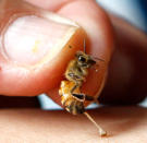 <b>Bee venom: for agile joints</b><br>A bee sting therapist holds a bee to sting the arm of a patient in a bee farm in Silang, Cavite south of Manila June 6, 2012. REUTERS/Erik De Castro