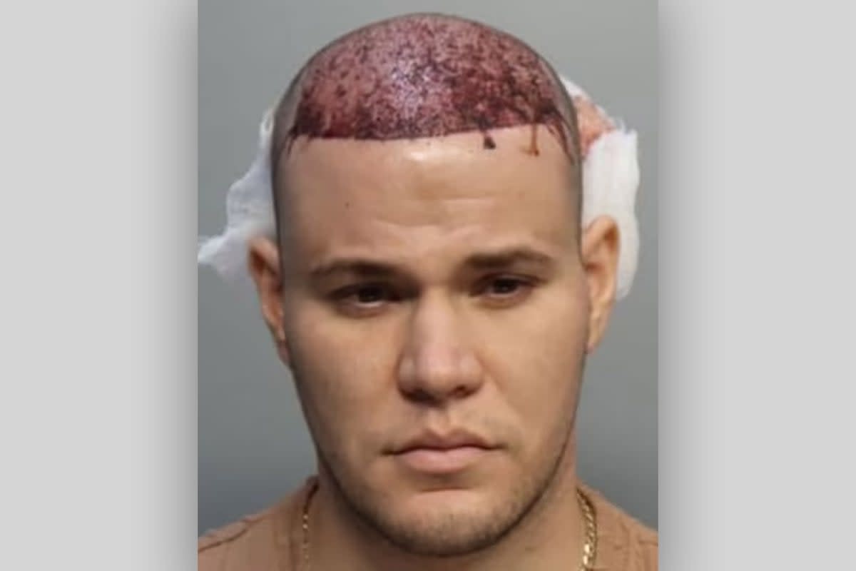 Eugenio Ernesto Hernandez-Garnier, 27, seen in mugshot  (Miami-Dade Corrections & Rehabilitation)