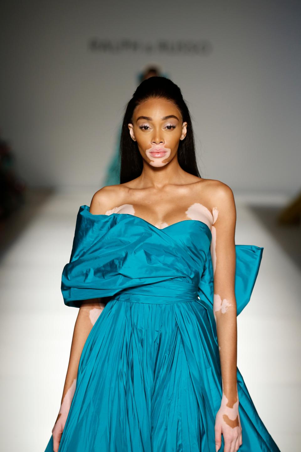 Winnie Harlow