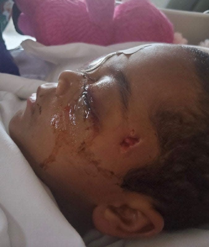 Malakai Roberts is a 6-year-old boy from Lexington, Kentucky, who was blinded when bullets ripped through his home just days before Christmas in 2020.