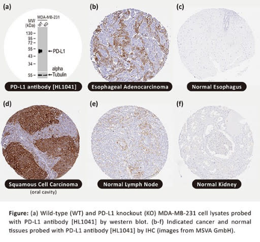 PD-L1 Antibody [HL1041] IHC