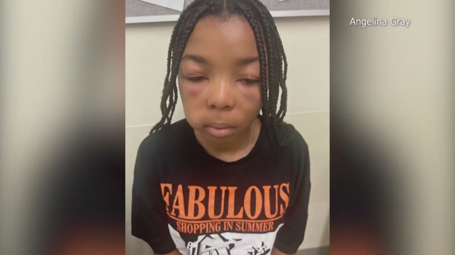 Kassidy Jones, 13, is speaking out after she was beaten inside a Los Angeles McDonald's by a unknown woman on on Sept. 6, 2023. (KTLA)