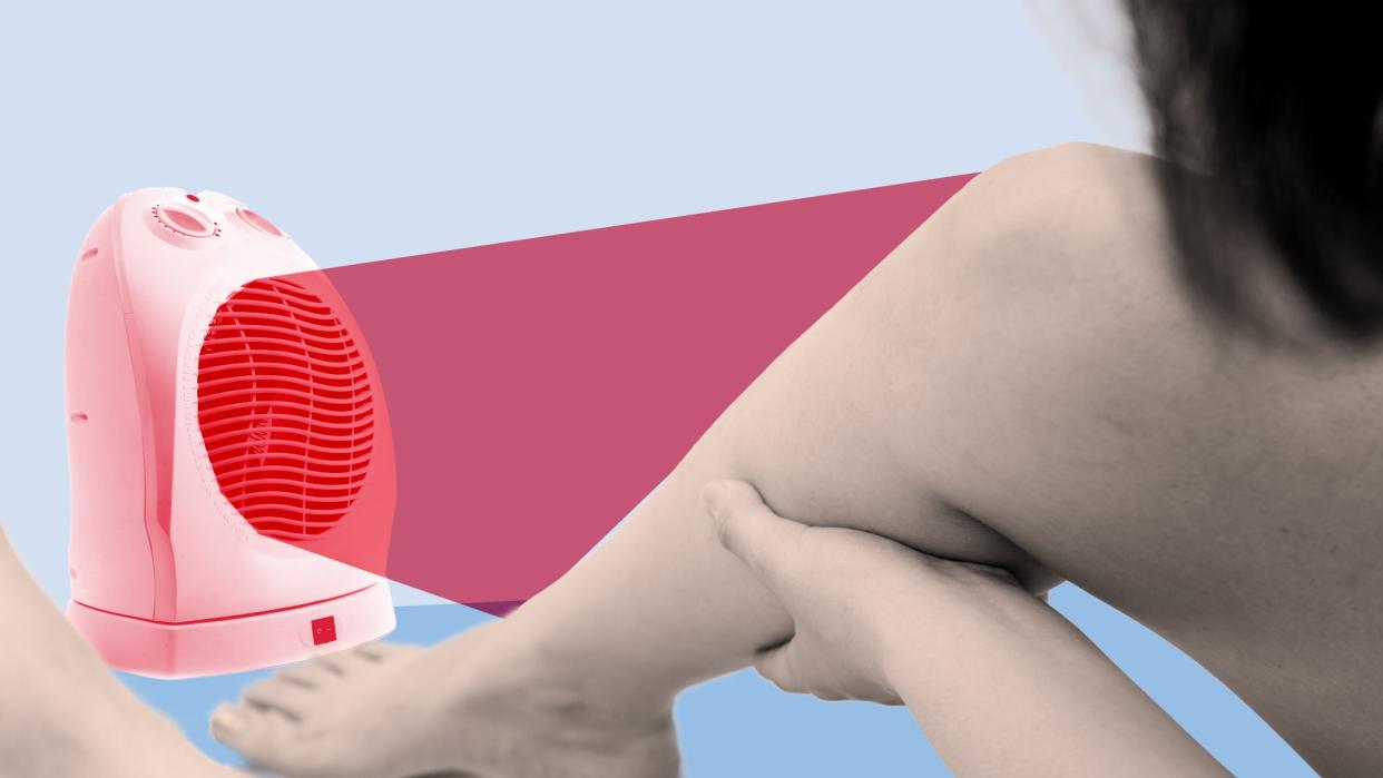 photo collage of a model with bare legs in front of a portable heater that seems to be radiating heat to resemble toasted skin syndrome