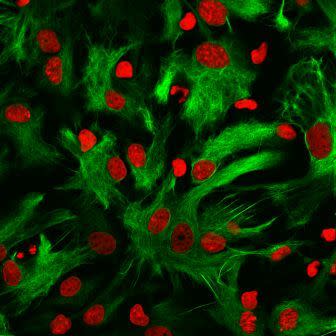 Rat neurons (blue) astrocytes (red) other glial cells (oligodendrocytes, green) in cell culture