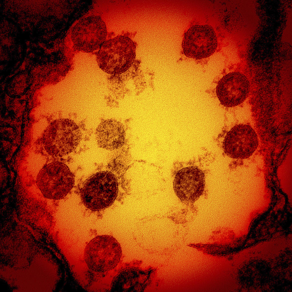 Numerosas variantes del coronavirus causante del covid-19 se han identificado en el mundo, algunas de ellas inquietantes por ser más contagiosas, más agresivas o capaces en cierto grado de evadir la inmunidad de las vacunas. (NIAID/National Institutes of Health via AP)