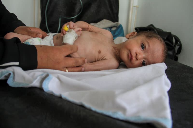 Six-month-old with chest infection in Gaza shows how children starve