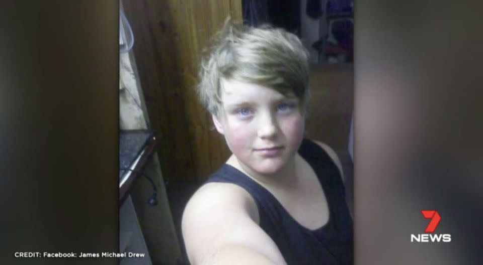 James, 16, has a broken leg. Source: 7 News/Facebook