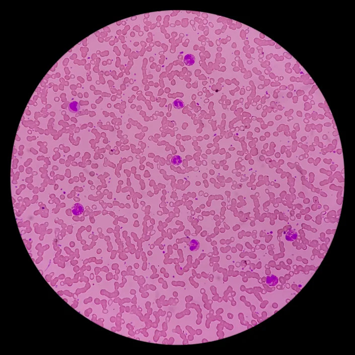 Eosinophilia is simply a information  that occurs erstwhile   your assemblage  produces an usually   precocious   fig   of eosinophils, pictured present  successful  a microscopic image. (Photo via Getty Images)