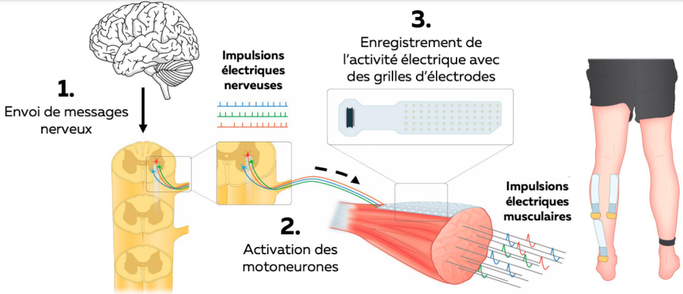 Schéma du principe de l’électromyographie (EMG) haute densité. Fourni par l'auteur