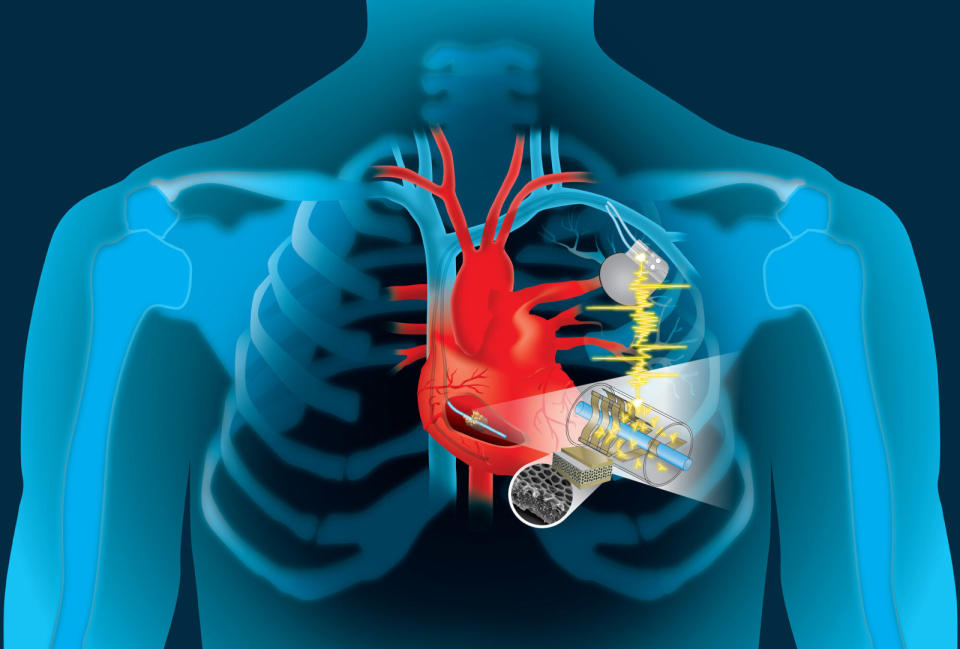 Millions of people around the world depend on pacemakers, defibrillators and